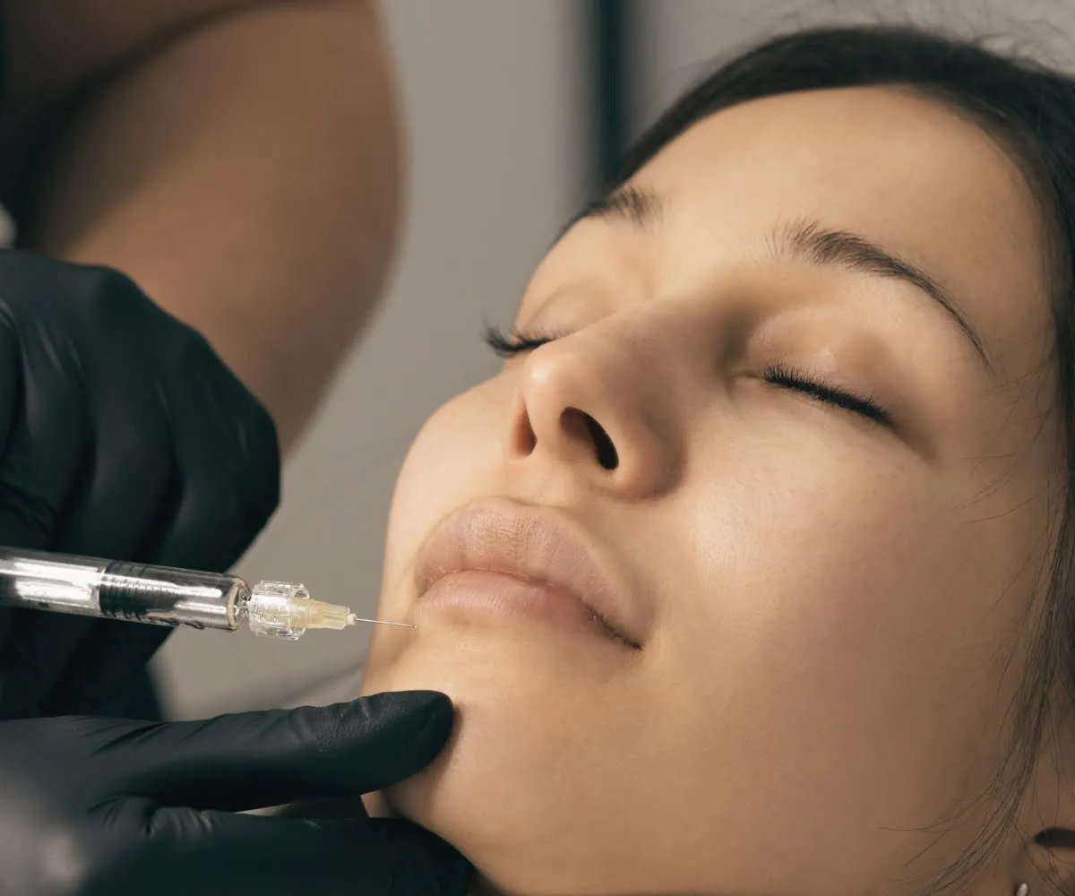 revanesse-dermal-filler-injectable-treatment-buffalo